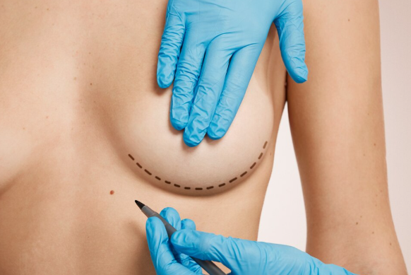 Who is the Best Surgeon for Tummy Tuck and Breast Lift in Ludhiana?
